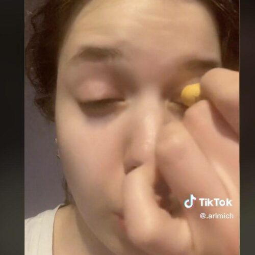 TikTok : Το νέο επικίνδυνο trend pου βλάπτει τα μάτια